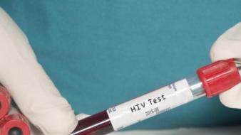 Тестування на ВІЛ та профілактика