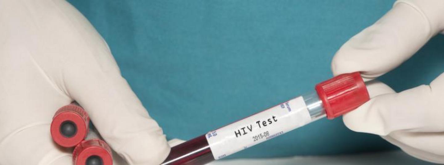 Тестування на ВІЛ та профілактика