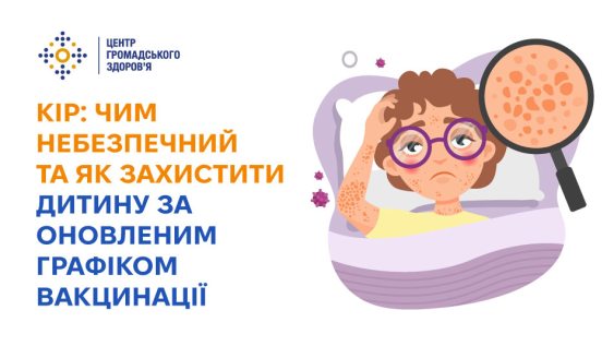 Кір: чим небезпечний та як захистити дитину за оновленим графіком вакцинації