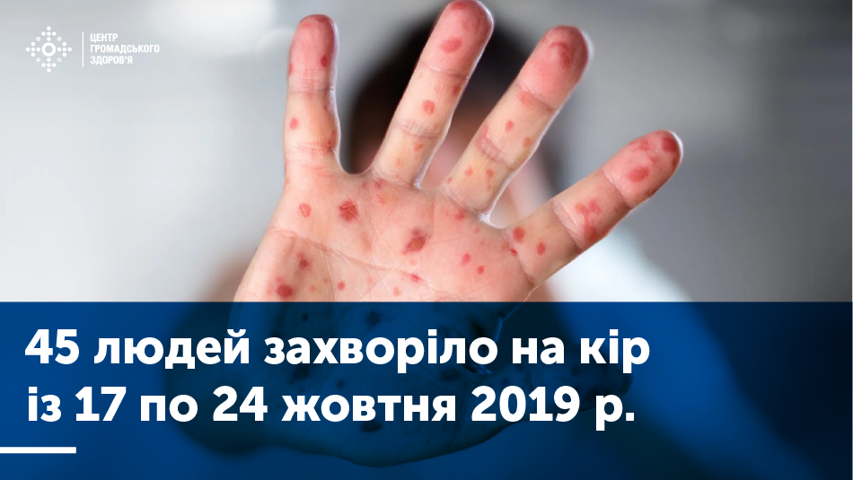 Дані захворюваності на кір  (17 – 24 жовтня 2019)