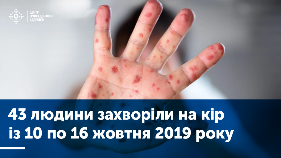 Дані захворюваності на кір (10–16 жовтня 2019)