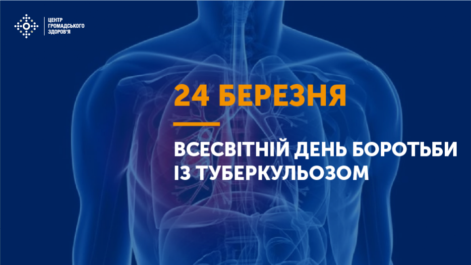 Лікування від туберкульозу в Україні безкоштовне