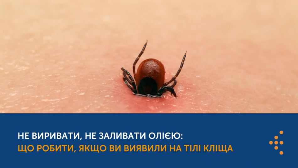 Не виривати, не заливати олією: Що робити, якщо ви виявили на тілі кліща