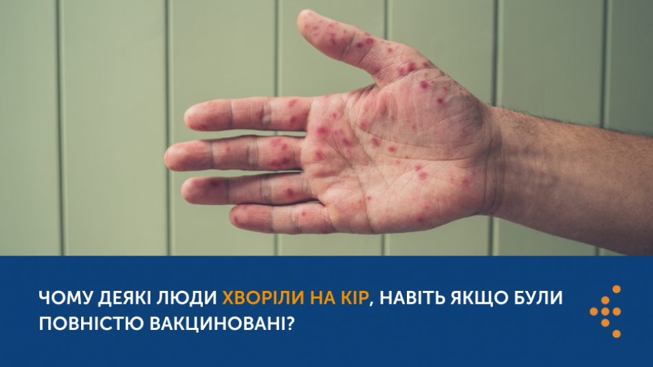 Повністю вакцинована людина хворіє на кір: чому так стається