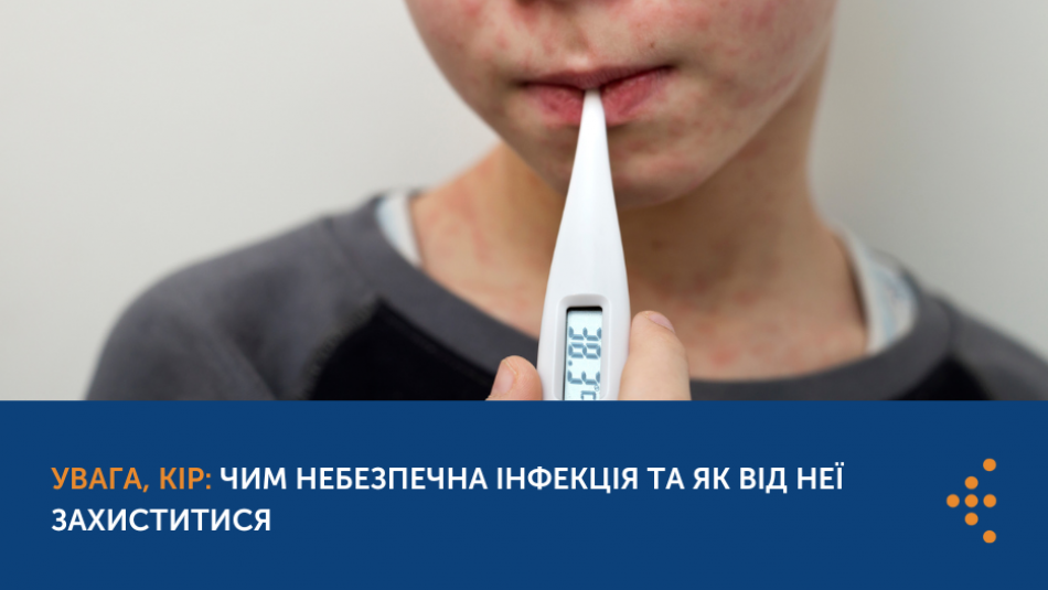 Увага, кір: чим небезпечна інфекція та як від неї захиститися