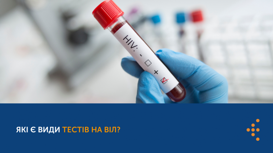 У Європейський тиждень тестування розповідаємо, які є види тестів на ВІЛ