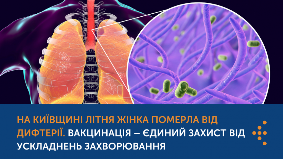 На Київщині зареєстровано летальний випадок від дифтерії 
