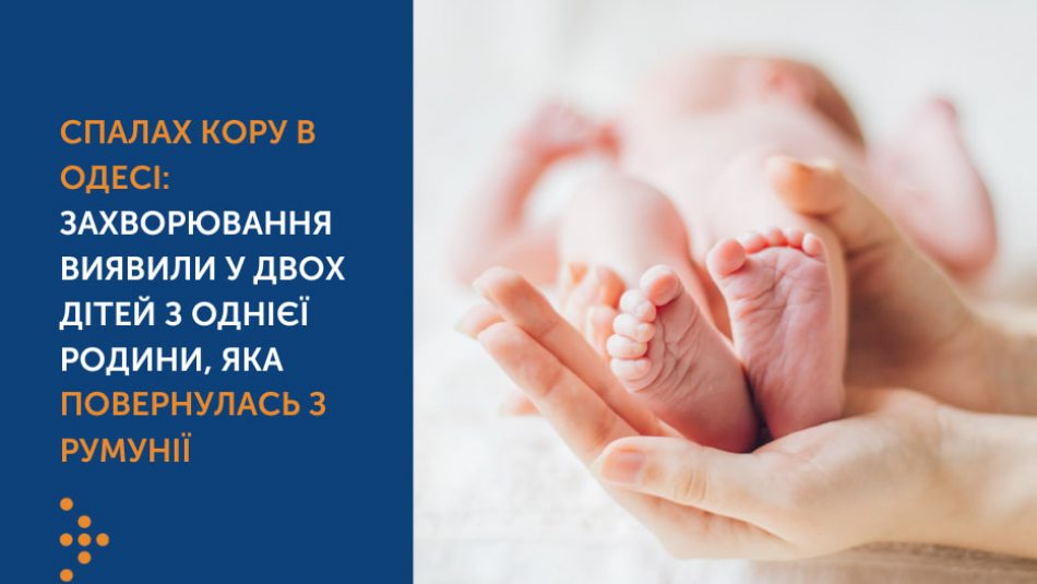 В Одесі спалах кору: захворювання виявили у двох дітей з однієї родини, яка повернулась з Румунії