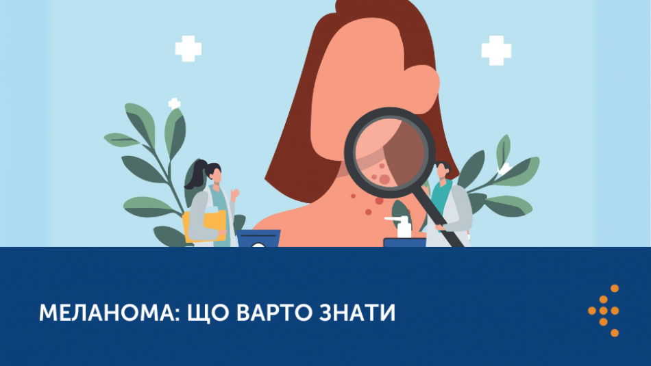 Меланома: як вчасно розпізнати та запобігти її розвитку? 