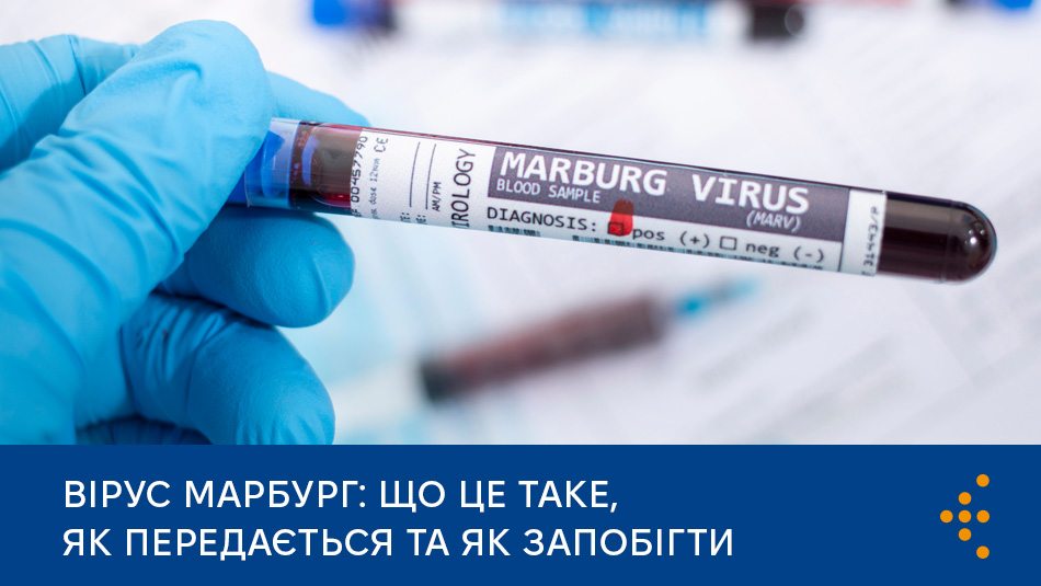 Вірус Марбург: що це таке, як передається та як запобігти 