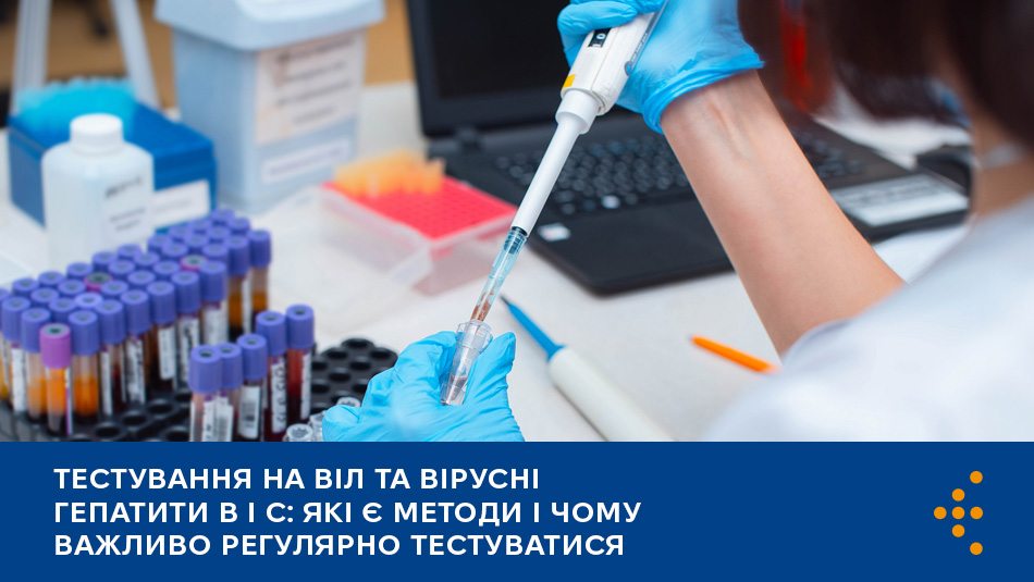 Тестування на ВІЛ та вірусні гепатити B і C: які є методи і чому важливо регулярно тестуватися