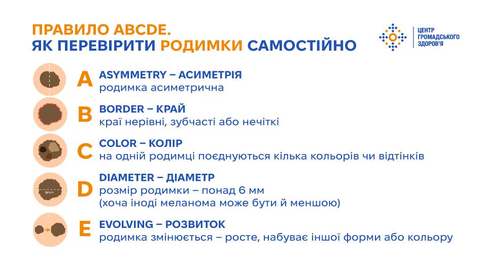 Травень — місяць обізнаності про меланому. Як їй можна запобігти та коли звертатися до лікаря