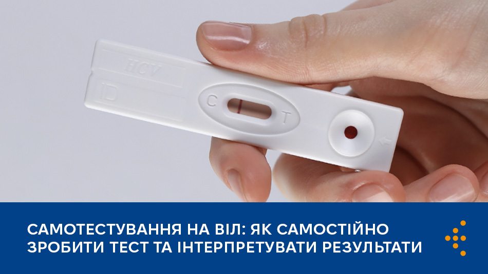 Самотестування на ВІЛ: як самостійно зробити тест та інтерпретувати результати