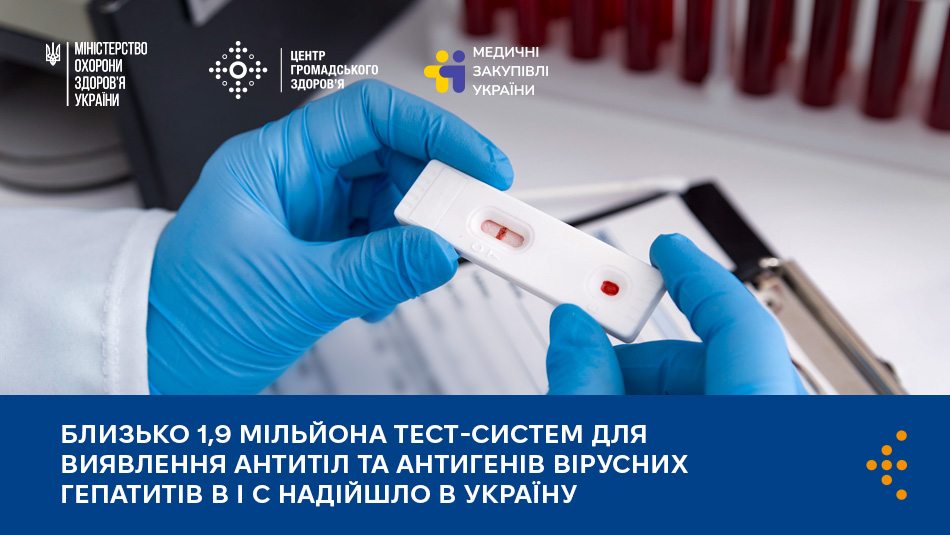 Близько 1,9 мільйона тест-систем для виявлення антитіл та антигенів вірусних гепатитів B і С надійшло в Україну