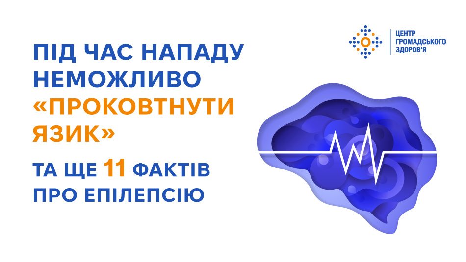 Під час нападу неможливо «проковтнути язик» — та ще 11 фактів про епілепсію
