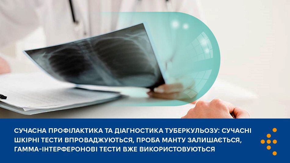 манту не скасовують