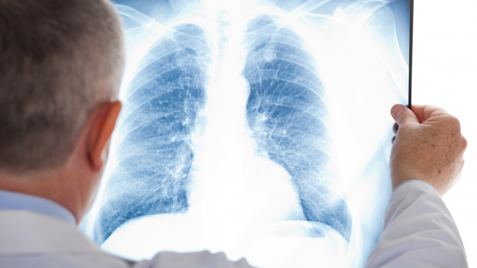 Лікування хворих на мультирезистентний туберкульоз станом на 1 вересня 2015 року